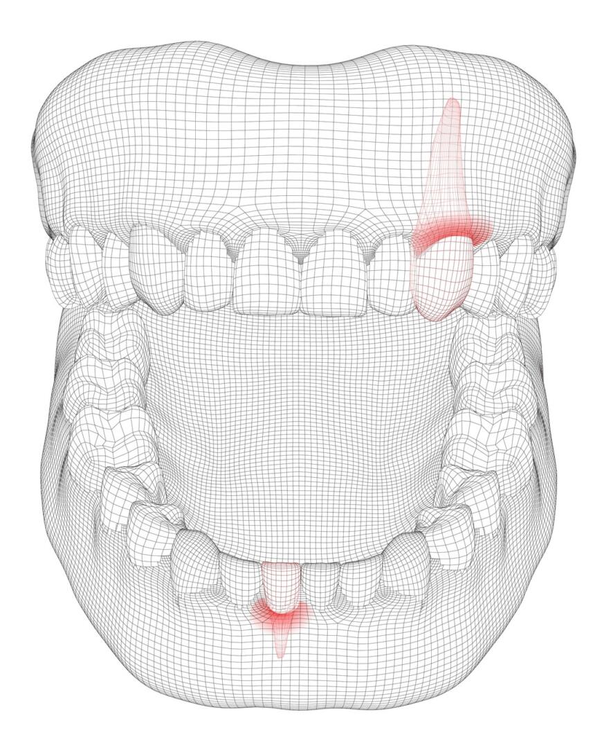 INSTRUCTIONS FOR DENTAL PROBLEMS